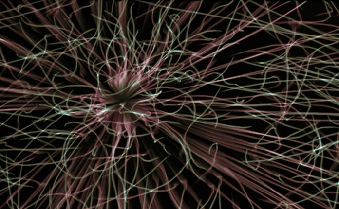 Photo Complex neural network