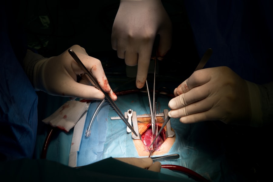 Photo Robotic Surgery